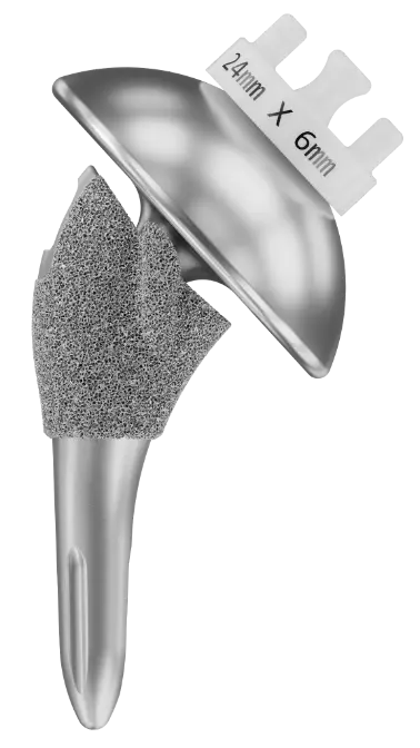 InSet® anatomic total shoulder replacement implant from Shoulder Innovations